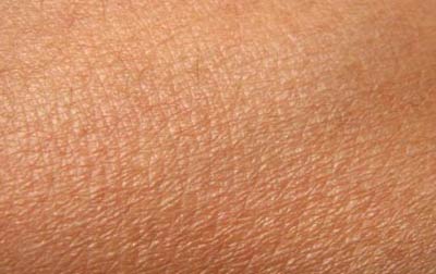 الصيام علاج فعال للأمراض الجلدية