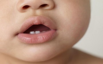 العوارض المرافقة لظهور أسنان الطفل